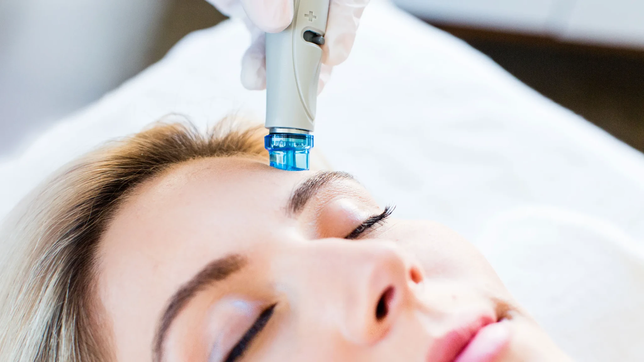 HydraFacial Microneedling
