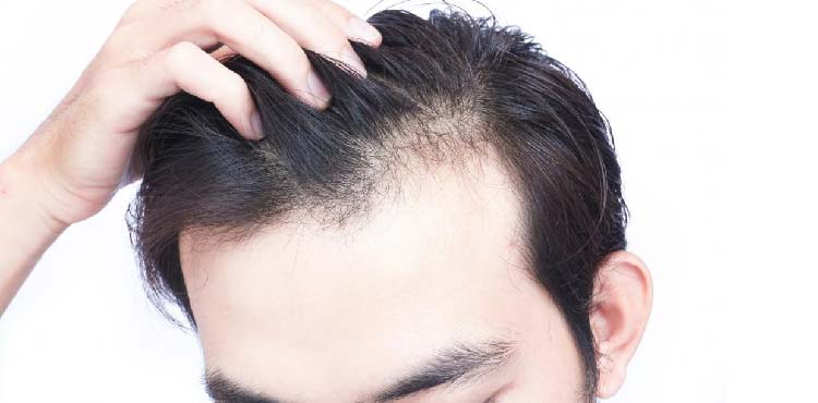Hair Loss PRP Treatment